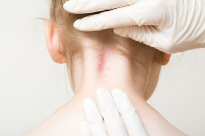 παιδιατρική δερματολογία παθήσεις